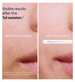Braun Smart IPL Skin i·expert, At Home Hair Removal, Pouch, Venus Razor, 2 Heads, PL7147
