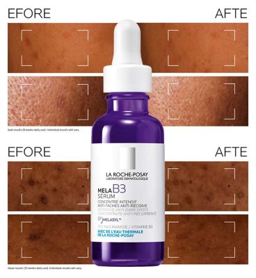 La Roche-Posay MelaB3 Serum: Intense Anti-dark Spot Serum for Hyperpigmentation 30ml