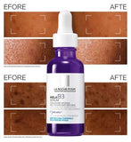 La Roche-Posay MelaB3 Serum: Intense Anti-dark Spot Serum for Hyperpigmentation 30ml