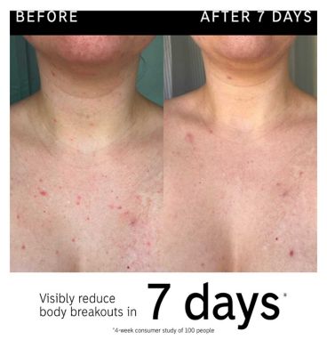 The INKEY List Glycolic Acid Exfoliating Body Stick
