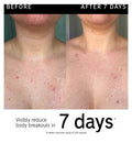 The INKEY List Glycolic Acid Exfoliating Body Stick