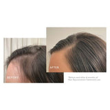 Virtue Hair Rejuvenation Treatment Kit (Phyto-Follicle Nutrient) Full Size, 90 day  (INTL)