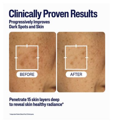Cetaphil Healthy Radiance Brightening Serum with Niacinamide for Dark Spots, 30ml