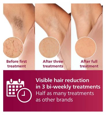 Philips Lumea Series 7000 BRI920/00, IPL Hair Removal Device