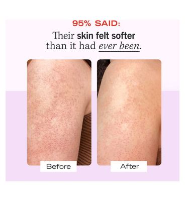 First Aid Beauty KP Smoothing Body Scrub with 10% AHA 226g