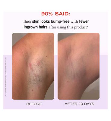 First Aid Beauty Ingrown Hair Pads with BHA&AHA 60 Pads