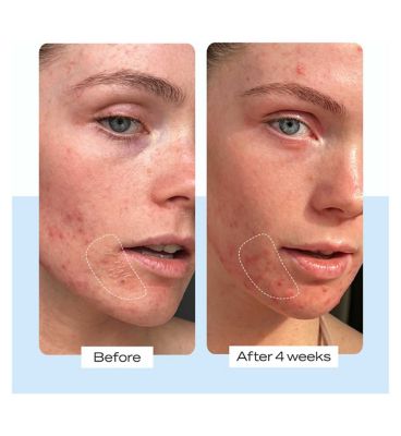First Aid Beauty Ultra Repair Cream 56.7g