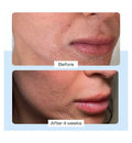 First Aid Beauty Ultra Repair Cream 170g