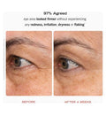 First Aid Beauty Retinol Eye Cream with Squalane + Ceramides 15ml