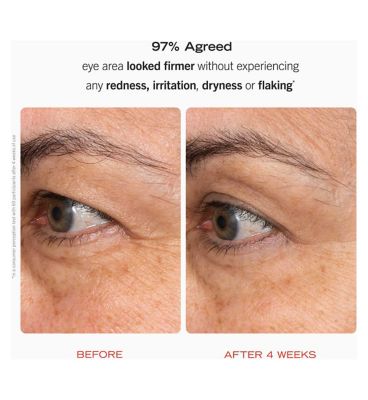 First Aid Beauty Retinol Eye Cream with Squalane + Ceramides 15ml