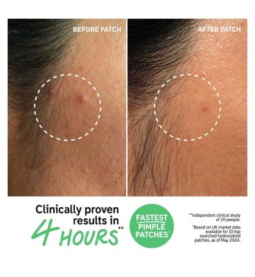 The INKEY List Hydrocolloid Invisible Pimple Patches 22 Patches