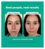 Proactiv Gentle 30 Day Kit