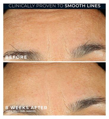 RoC RETINOL CORREXION Line Smoothing Night Serum Capsules for Visible Reduced Fine Lines & Wrinkles 30ct
