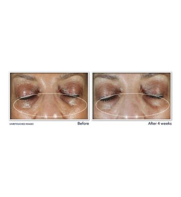 RoC Niacinamide Even Tone + Lift Eye Cream 15ml