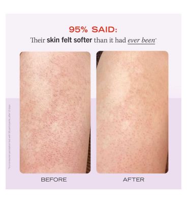 First Aid Beauty KP Bump Eraser Body Scrub 10% AHA - Fresh Strawberry 226g