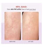 First Aid Beauty KP Bump Eraser Body Scrub 10% AHA - Fresh Strawberry 226g