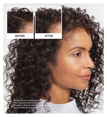 Nioxin Anti-Hair Loss Shampoo 240ml