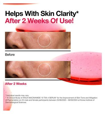 Anua Niacinamide 10% and TXA 4% Serum 30ml