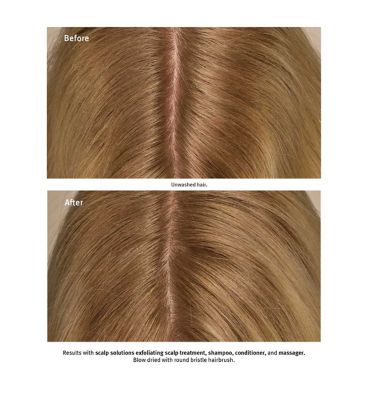 AVEDA Scalp Solutions Exfoliating Scalp Treatment 150ml