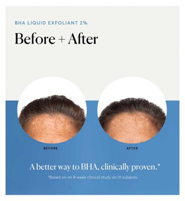 NATURIUM BHA Liquid Exfoliant 2% 120ml