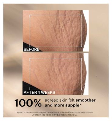 StriVectin SD Advanced PLUS Intensive Moisturizer
