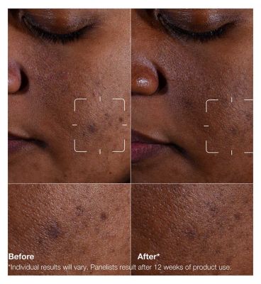 Clinique Even Better Clinical™ Dark Spot Clearing Serum 50ml