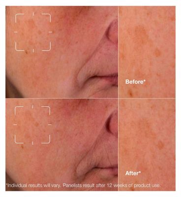 Clinique Even Better Clinical™ Dark Spot Clearing Serum 50ml