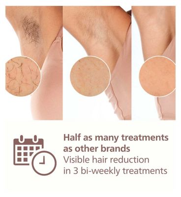 Philips Lumea 9900 Series, IPL Hair Removal Device with SkinAI Technology, 4 Attachments, Corded & Cordless Use, BRI951/01