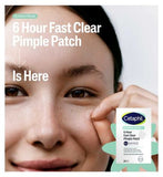 Cetaphil Gentle Clear Pimple Patches, 6 Hour Fast Clear with Salicylic Acid for Blemish-Prone Skin, 24 Emerging Spot Patches