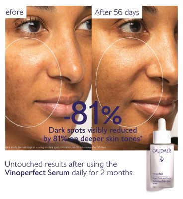 Caudalie Vinoperfect Serum And Suncare Set 2025