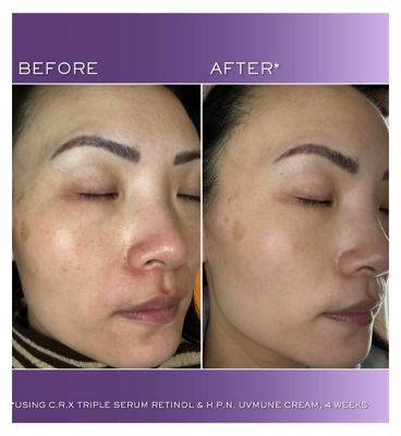 Lancôme Rénergie C.R.X Triple Serum Retinol, Anti-Ageing And Anti-Wrinkle 50ml