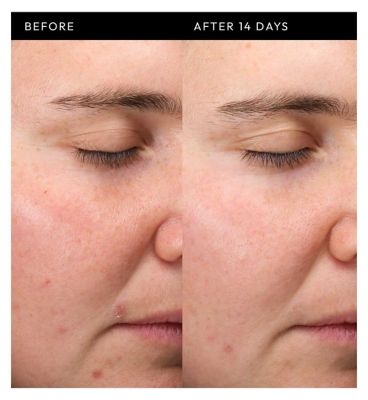 The Inkey List Exosome Hydro-Glow Complex 30ml