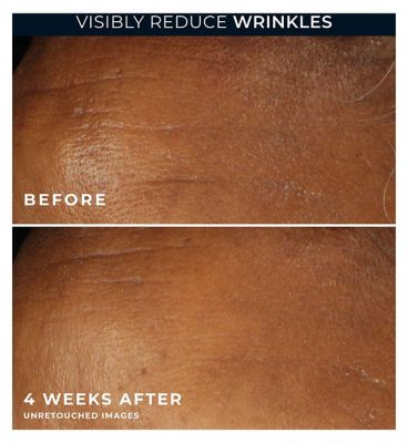 RoC Retinol Correxion Wrinkle Correct Daily Moisturiser Spf30 30ml