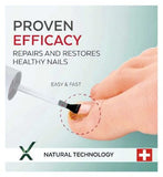 PODERM Fungal Nails Treatment Serum (8ml) Eliminates Fungus And Restores A Healthy-Looking Nail