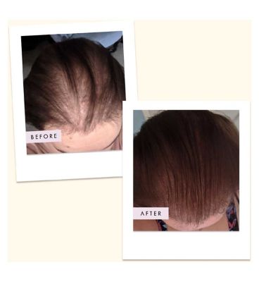 Boots Hair Gain Vegan Hair Gummies - 60s