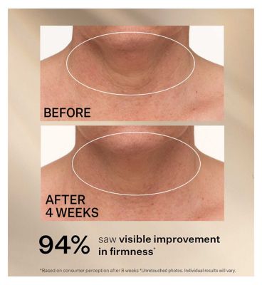 StriVectin Advanced Tightening Neck Cream Light 50ml