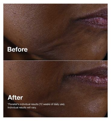 Clinique Smart Day-To-Night Anti-Ageing Skincare Set