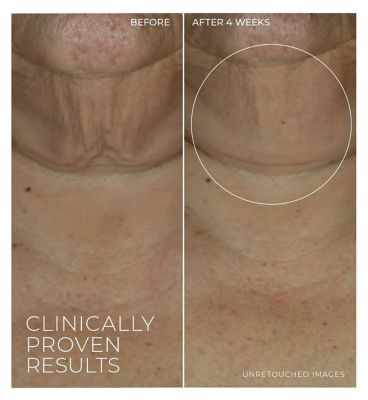 RoC Derm Correxion Retinol Firming Serum Stick to Lift, Tighten & Smooth Fine Lines 30g