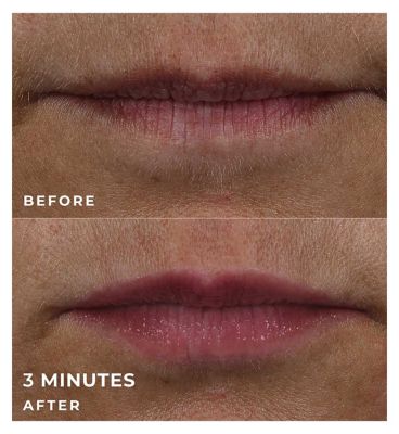 RoC Derm Correxion Lip Volumizer with Hyaluronic Acid 10ml