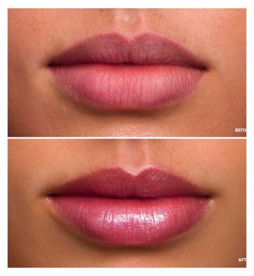 Wonderskin Wonder Blading Top Gloss