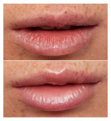 Wonderskin Lip Rehab Serum Oil - Clear - 3.6ml