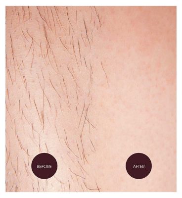 Nad's Strawberries & Cream Waxing Dots 200g