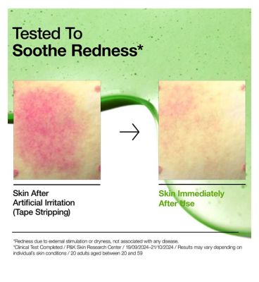 Anua Azelaic Acid 10 Hyaluron Redness Soothing Serum 30ml