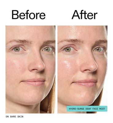 The Inkey List Hydro-Surge Dewy Face Mist 75ml
