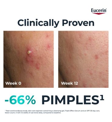 Eucerin DERMOPURE CLINICAL Triple Action Serum 40ml