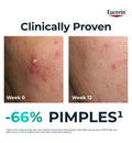 Eucerin DERMOPURE CLINICAL Triple Action Serum 40ml