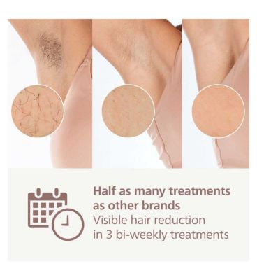 Philips Lumea 9900 Series, IPL Hair Removal Device, With SkinAI Technology, 3 Attachments, Corded & Cordless Use, BRI953/02