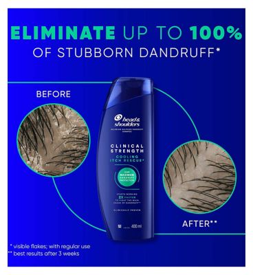 Head & Shoulders Cooling Itch Rescue 400ml Selenium Sulfide Anti-Dandruff Shampoo