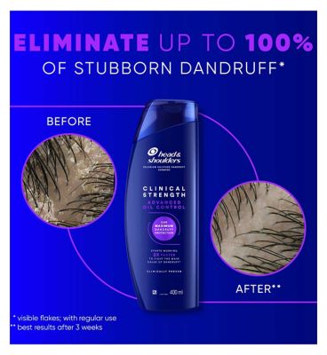 Head & Shoulders Advanced Oil Control 400ml Selenium Sulphide Anti-Dandruff Shampoo
