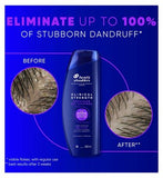 Head & Shoulders Advanced Oil Control 400ml Selenium Sulphide Anti-Dandruff Shampoo